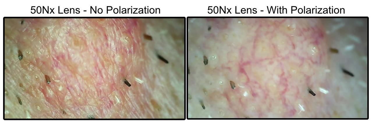 ProScope T1 Kit w/50Nx and 200x lens WiFi Microscope